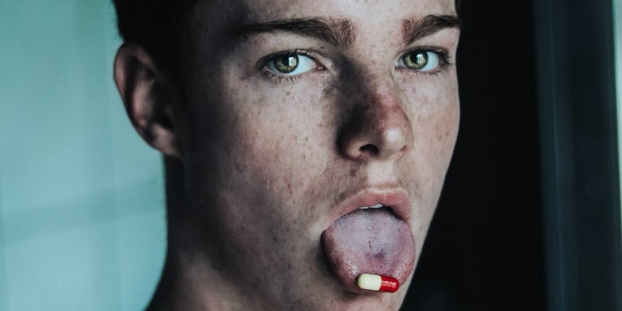Image depicting a swollen tongue with white patches, representing the rare COVID-19 symptom known as 'COVID tongue